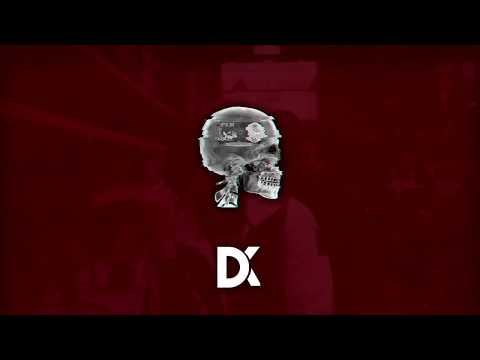 (FREE) PLK x Timal x Lacrim x Damso x Ninho TYPE BEAT "MENTAL ", Prod by DoKca