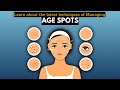 Learn About the Latest Techniques for Managing Age Spots