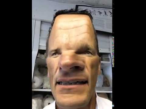 Mijne moat es zijne patiënt vergete