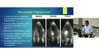 Alcohol Septal Ablation for HOCM – Dr Rohan Bhagwandeen