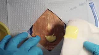 Incision and Drainage of Cutaneous Abscesses
