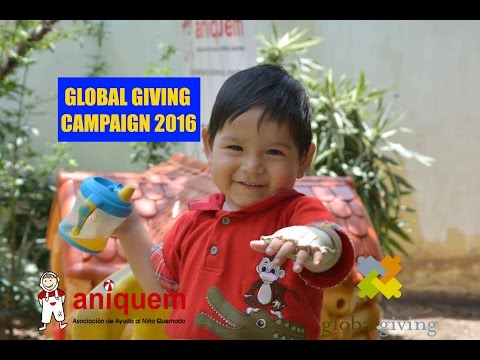 One Year Physiotherapy for 30 Burned Peruvian Kids