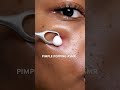 Pimple Popping ASMR Skincare Melanin Skin Uneven Skin Tone AI Clear Skin Products For Dark Skin