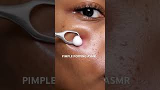 Download lagu Pimple Popping ASMR Skincare Melanin Skin | Uneven Skin Tone AI Clear Skin Products for dark skin mp3 Download lagu Pimple Popping ASMR Skincare Melanin Skin | Uneven Skin Tone AI Clear Skin Products for dark skin mp3
