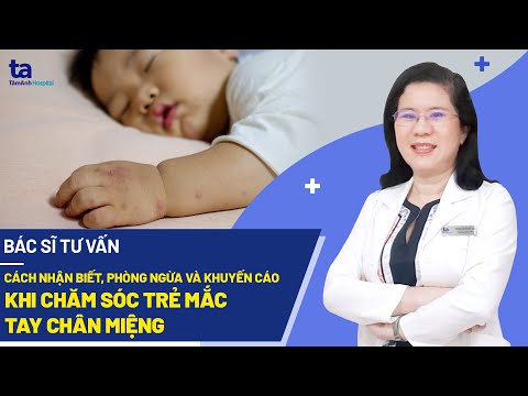 Bệnh tay chân miệng ở trẻ em: Nguyên nhân, biểu hiệu và cách điều trị hiệu quả 