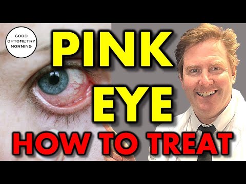 WHAT CAUSES PINK EYE & HOW TO TREAT PINK EYE: youtube eye doctor explains conjunctivitis