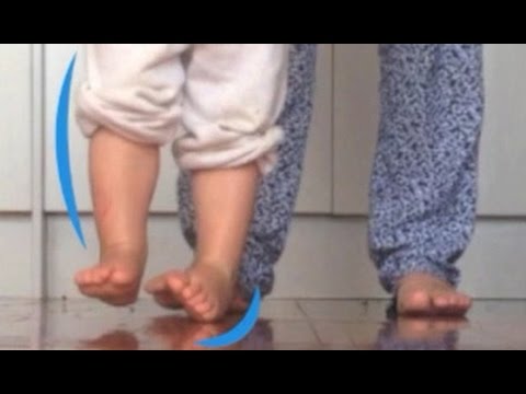 Ludzka stopa guz na pięcie Bardzo obolały na kości stopy