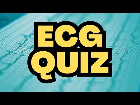 ECG Quiz