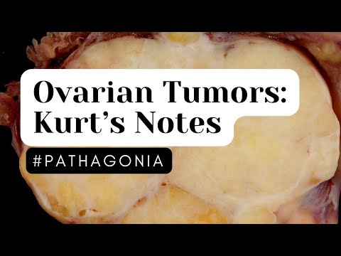 Ovary Tumors: Kurt’s Notes #pathagonia