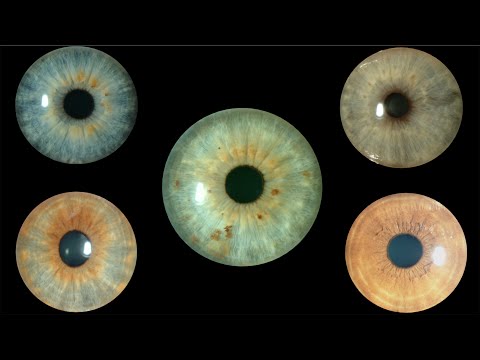 El color de los ojos: ojos grises y verdes. Centro de Oftalmología Bonafonte. Barcelona. (España)
