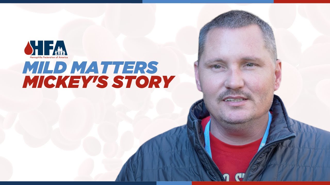 Mild Matters - Mickey
