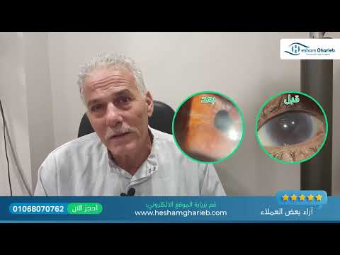 زرع الخلايا الداخلية جعلت عم ابراهيم يبصر مرة تانية 😊