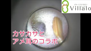 耳掃除動画vol.69「カサカサとアメ耳のコラボ」