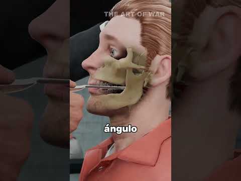 ¿Cómo una cuchara podría silenciar una fuga? (@theartofwarrr )