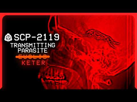SCP-2119 │ Transmitting Parasite │ E̶u̶c̶l̶i̶d̶ Keter │ Neurological/Parasitic SCP