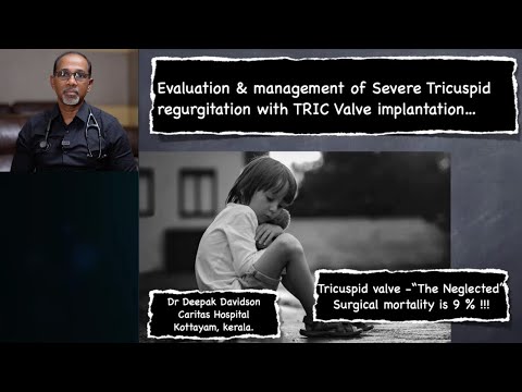 Tric valve implantation | echo severe tricuspid regurgitation | Echo for tric valve implantation |