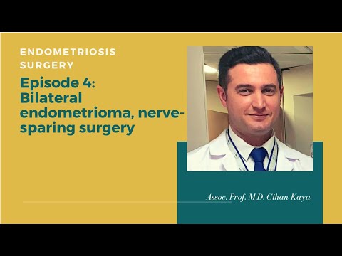 Bilateral Endometrioma