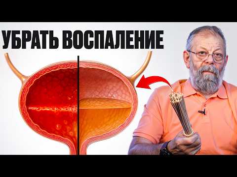 Мочевой пузырь — покажу как быстро вылечить простым веником!