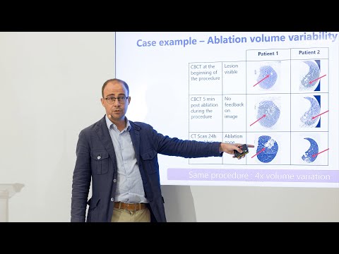 Thomas Bancel, HEPTA MEDICAL - Advanced Medical Solutions | LSI Europe '25