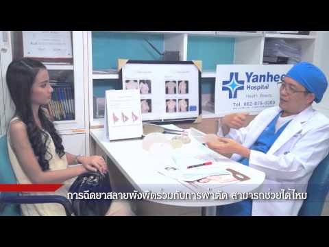 Lindinet enlarge หน้าอก หน้าอกเล็กในยกทรง