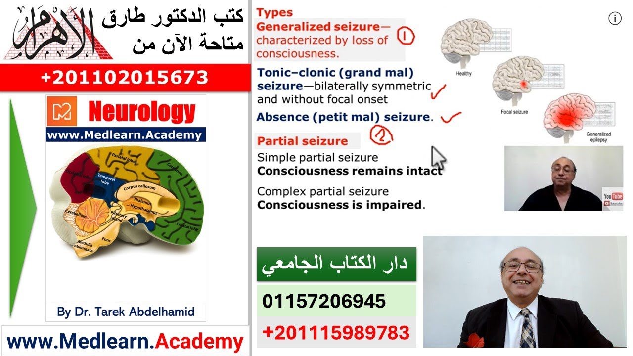 Epilepsy (1)  #usmle #internal_medicine #cme  #محاضرات_باطنة #medlearn #medicalcollege