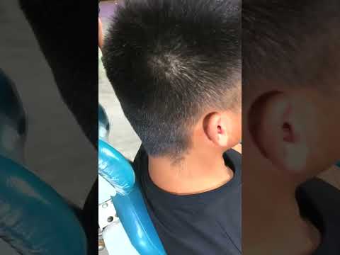 TOTAL OBSTRUCTION  EAR WAX REMOVAL  4KHD ep 16