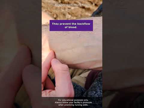 Hitting Vein Valves When Starting IVs or Drawing Blood (Venipuncture) #shorts