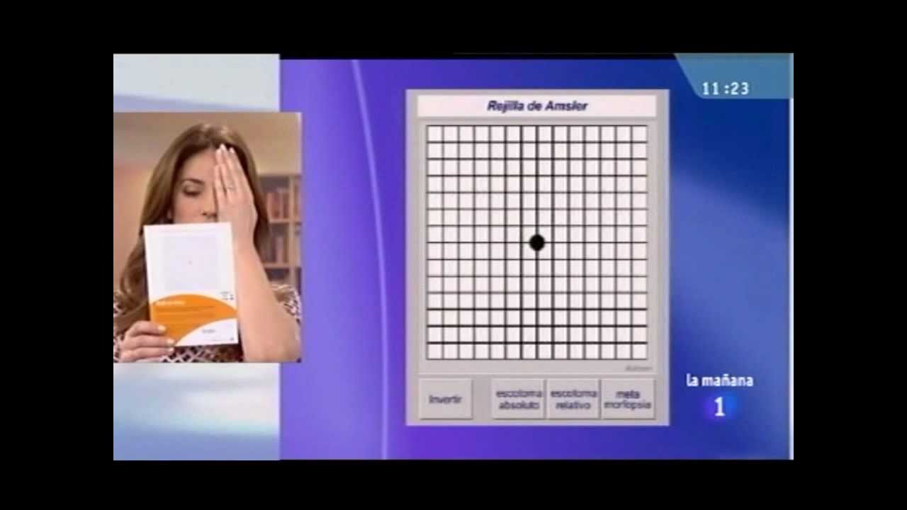 Rejilla de Amsler - Dr. Castillo