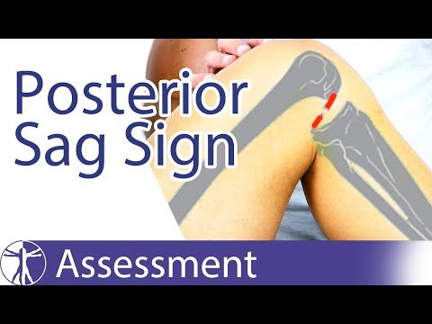Curare osteocondrosi incinta Il taglio del dolore nella vita posteriore