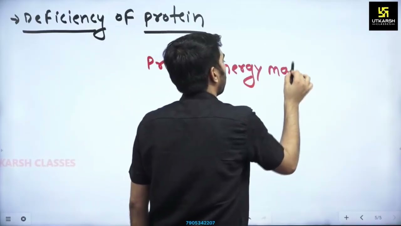 2- Protein/nutrition
