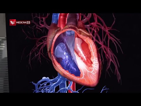 Fibrillazione atriale: la terapia con le radiazioni