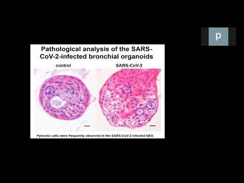 HCA Meeting Asia 2020: Co-current 3-3a - Generation of human lung model for COVID-19 research