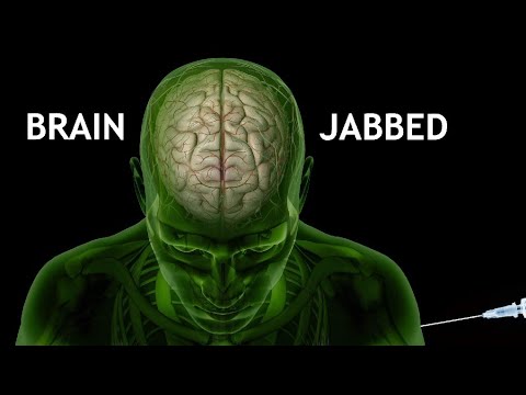 Brain Jabbed - w/ David Fergusson (2022) [Richplanet TV Show 295]