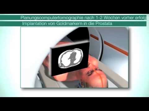 Verschreibungspflichtige Behandlung von Volksmittel Prostatitis Prostatitis Symptome und Behandlung Drogen
