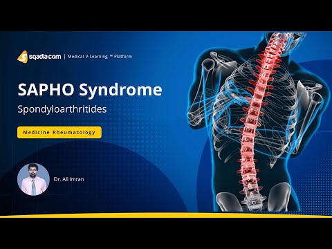 Spondyloarthritides | SAPHO Syndrome