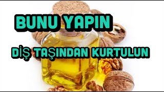 DİŞ TAŞI PROBLEMLERİNE EVDE DOĞAL VE KESİN ÇÖZÜMLER !!!