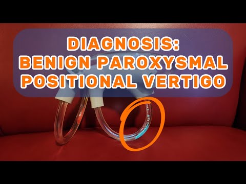 DIAGNOSIS: BPPV, Benign Paroxysmal Positional Vertigo - Dizzy Therapy