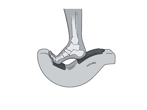 English instructions HEALMO - ankle joint.