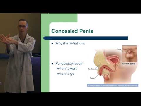 Potpourri  of Pediatric Urology  Part 2