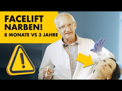 Sieht man die Narben nach dem Fächer-Facelift?! Dr. Jungwirth