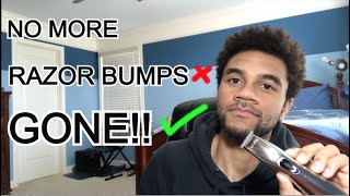 How To PREVENT RAZOR BUMPS - Get Rid of Razor Bumps & Ingrown Hairs