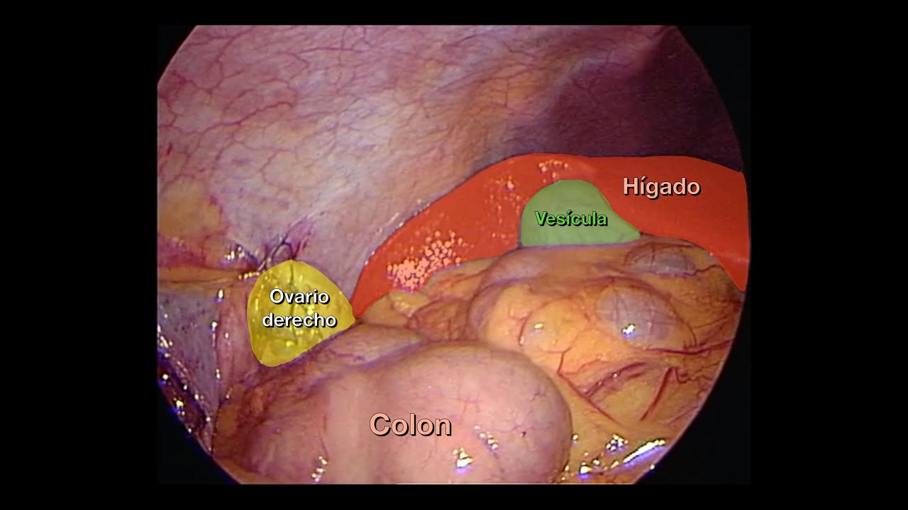 Albert Zevallos Cardenas-19