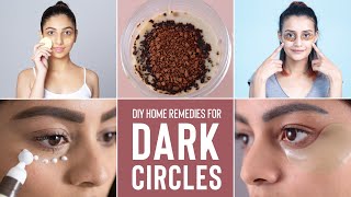 How To Get Rid Of DARK CIRCLES Naturally & Effectively | Home Remedies & DIY Masks!