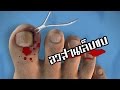 อาการ