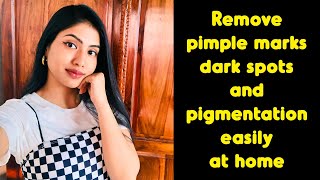 How to remove pimple marks | Yashi Tank|  Skincare