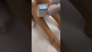 3RD GENERATION DIODE LASER MACHINE FEEDBACK