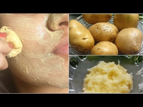Potato Facial Mask for Hyper Pigmentation