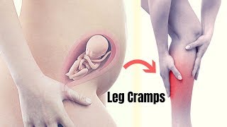 How To Cure Leg Cramps At Night During Pregnancy?