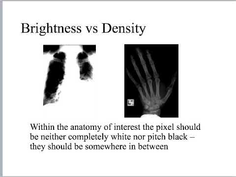 RAD 341 - Image Production - Visible Qualities of the X-ray