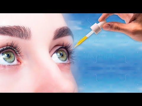 How to Get Rid of Eye Floaters Naturally